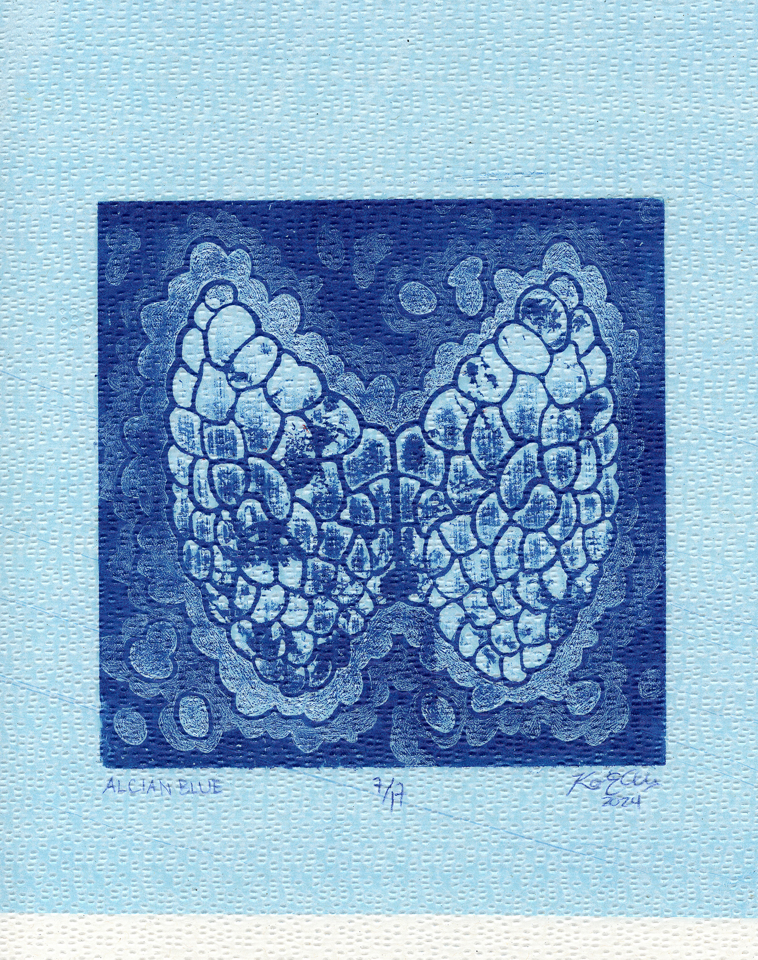 A stylized depiction of upside-down lungs is printed on a blue medical gown.