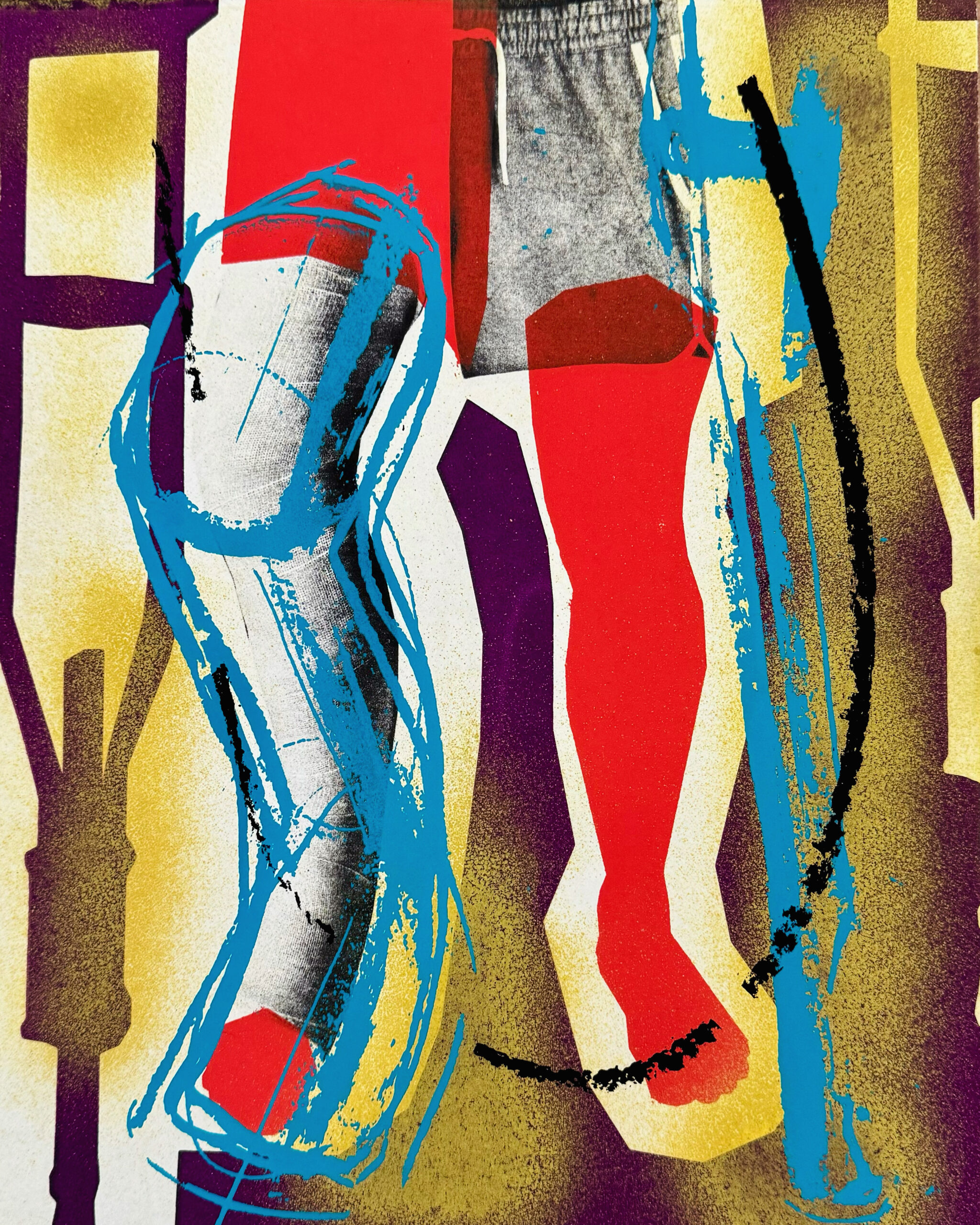 This collage print depicts legs, one leg with a cast and one leg is a red orange silhouette. The background depicts purple positive and negative depictions of crutches with a yellow spray paint mark and black oil pastel mark.